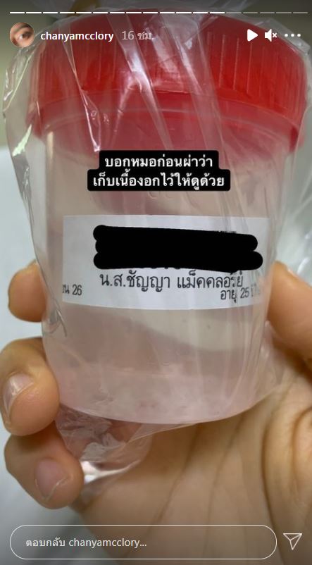 นิ้ง ชัญญา รีวิวการผ่าตัดสมอง จนชาวเน็ตลั่น! อยากลองบ้าง