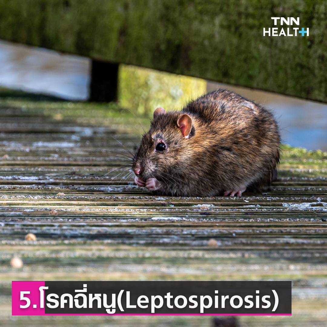 ุ6 โรคมาพร้อมฤดูฝน ป้องกันไว้ก่อนเจ็บป่วย ุ6 โรคมาพร้อมฤดูฝน ป้องกันไว้ก่อนเจ็บป่วย