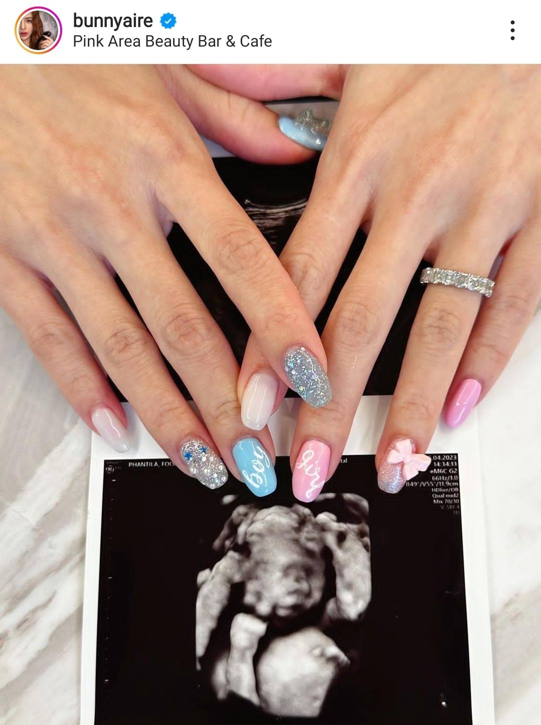 “แอร์ ภัณฑิลา” อัปเดตชีวิตว่าที่คุณแม่ป้ายแดง เผยได้ฤกษ์คลอดเดือนสิงหาคมนี้ “แอร์ ภัณฑิลา” อัปเดตชีวิตว่าที่คุณแม่ป้ายแดง เผยได้ฤกษ์คลอดเดือนสิงหาคมนี้