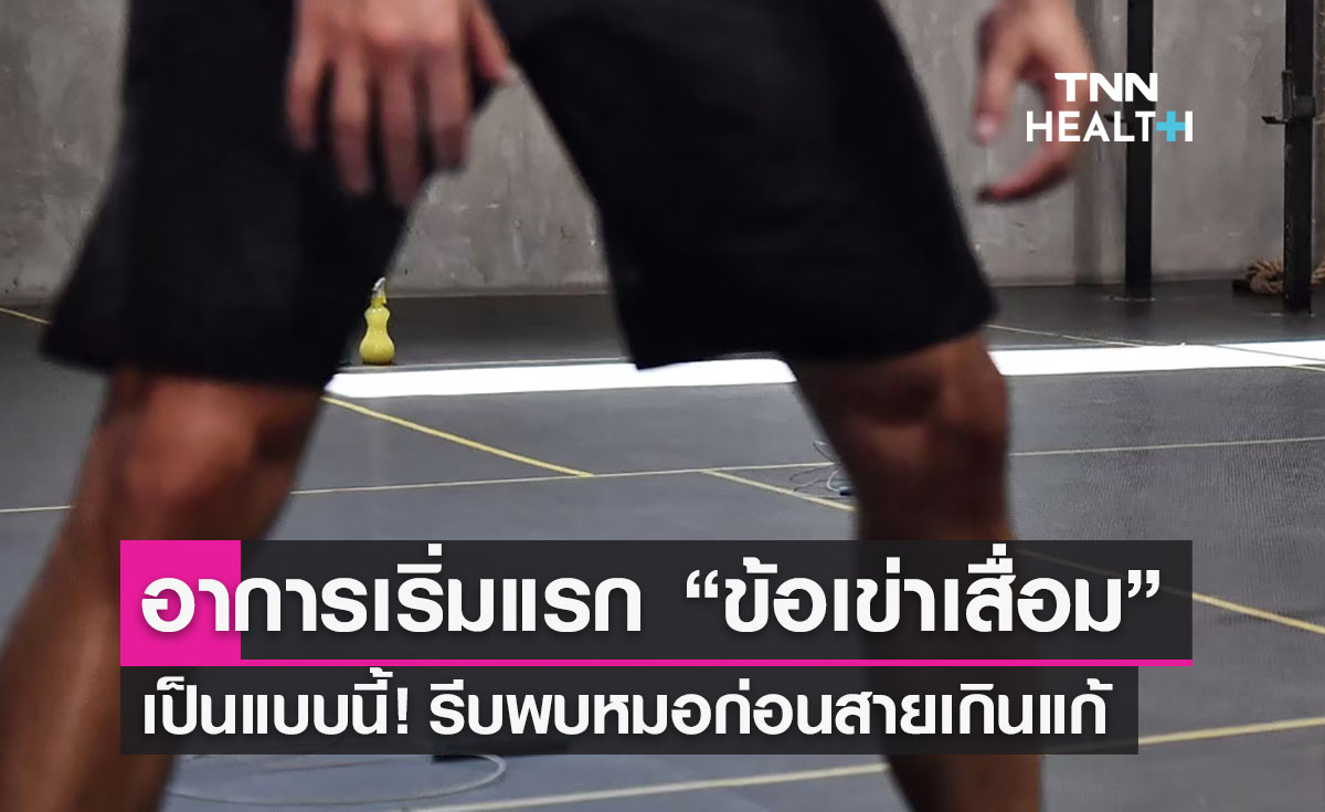 “ข้อเข่าเสื่อม” เปิดอาการป่วยระยะแรก รีบพบหมอก่อนสายเกินแก้