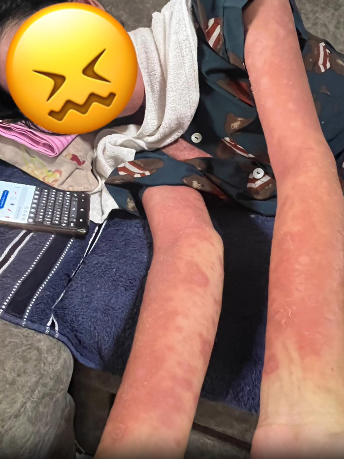 สาววัย 24 ปี แชร์ประสบการณ์ป่วย โรคแพ้ภูมิตัวเอง แนะใช้ชีวิตอย่างมีสติ