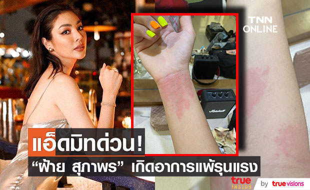  เเอ็ดมิทด่วน!! "ฝ้าย สุภาพร" เหตุเเพ้บาธบอมอย่างหนัก