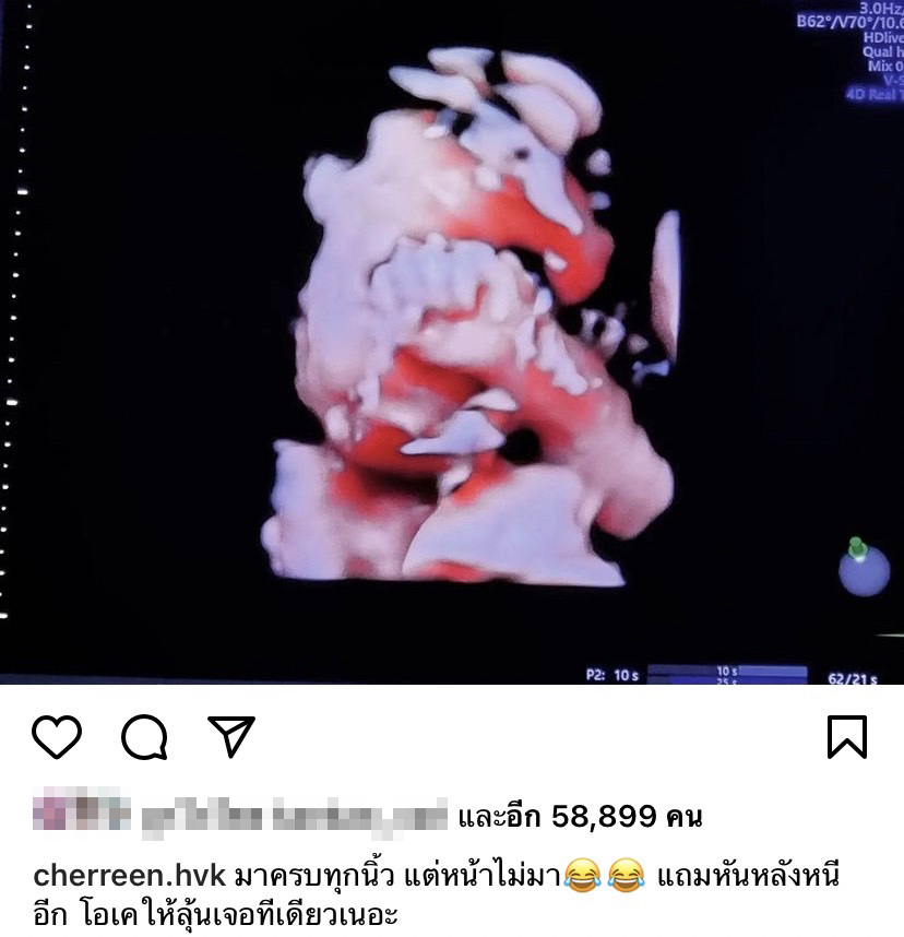 อบอุ่น น่ารัก เชอรีน ณัฐจารี อวดท้องโตถ่ายพรีเวดดิ้ง รวบภาพครอบครัว อบอุ่น น่ารัก เชอรีน ณัฐจารี อวดท้องโตถ่ายพรีเวดดิ้ง รวบภาพครอบครัว