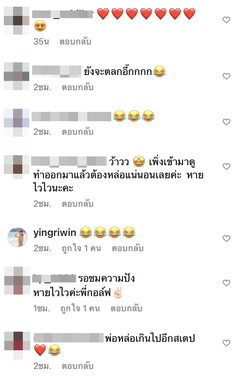 กอล์ฟ เบญจพล อัปเดตหลังเสริมหล่อ ถูกโทรศัพท์แกงหนัก จำหน้าไม่ได้?!  