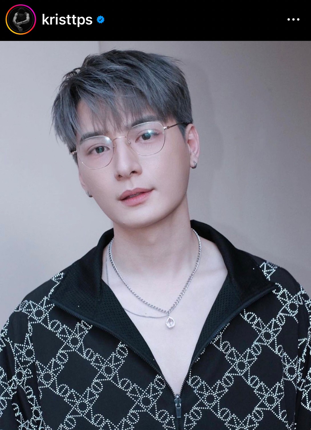 คริส พีรวัส อัปเดตโรคตาแห้ง ต้องรักษาตลอดชีวิต เผยสาเหตุยุติเส้นทางคู่จิ้น สิงโต