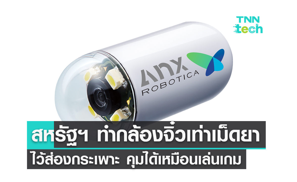 สหรัฐฯ ทำกล้องจิ๋วเท่าเม็ดยาส่องกระเพาะ ควบคุมทิศทางได้เหมือนเล่นเกม