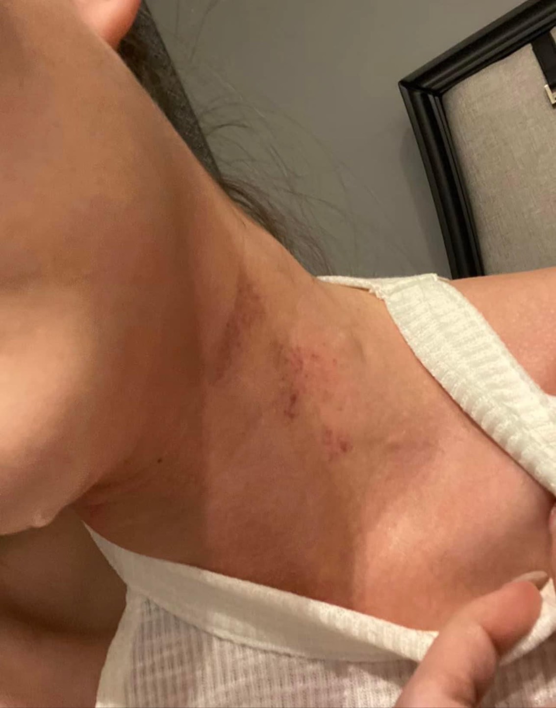 ไผ่ วันพ้อยท์ โพสต์ปกป้อง ดิว อริสรา พร้อมเผยภาพถูกทำร้ายร่างกาย