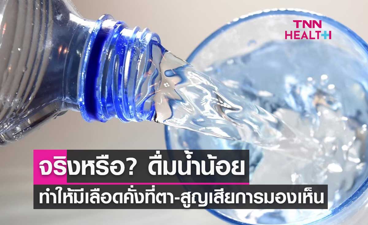 จริงหรือ? ดื่มน้ำน้อย ทำให้มีเลือดคั่งที่ตา-สูญเสียการมองเห็น