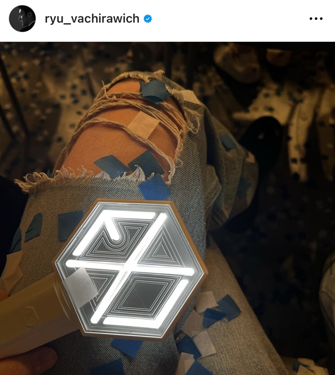 ริว วชิรวิชญ์ รับ ตู ต้นตะวัน ตรงสเปก สถานะตอนนี้ค่อยเป็นค่อยไป