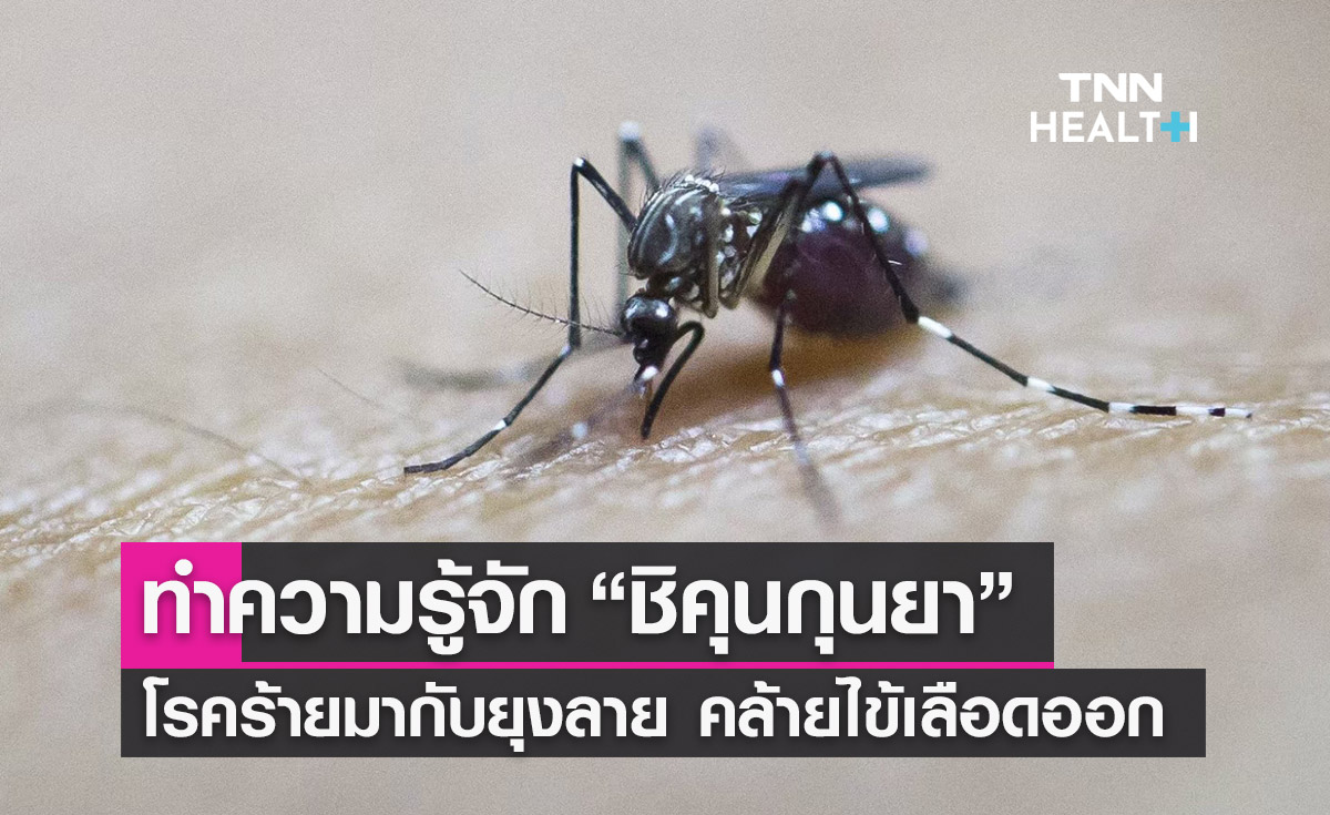 รู้จัก “ชิคุนกุนยา” โรคร้ายมากับยุงลาย คล้ายไข้เลือดออก