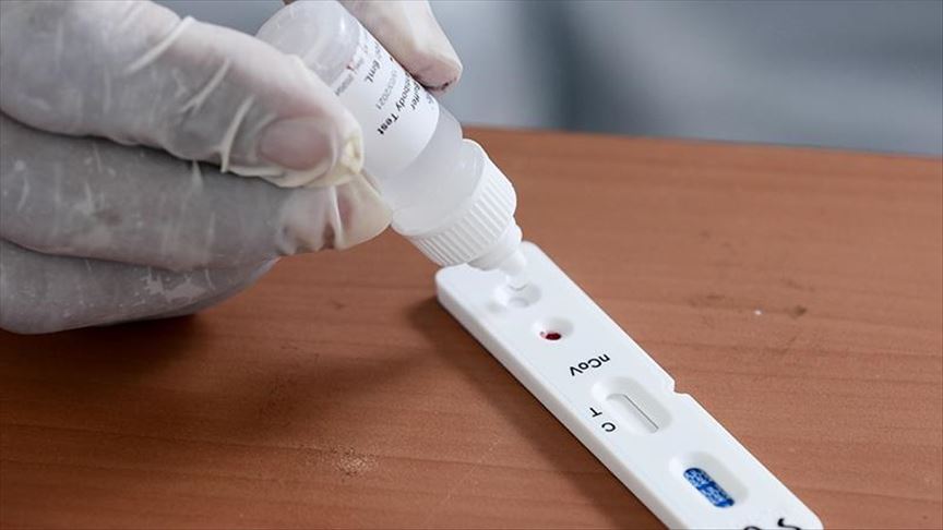 รู้จัก Rapid Antigen Test ชุดตรวจโควิดแบบเร่งด่วน รู้ผลเร็วภายใน 15 นาที