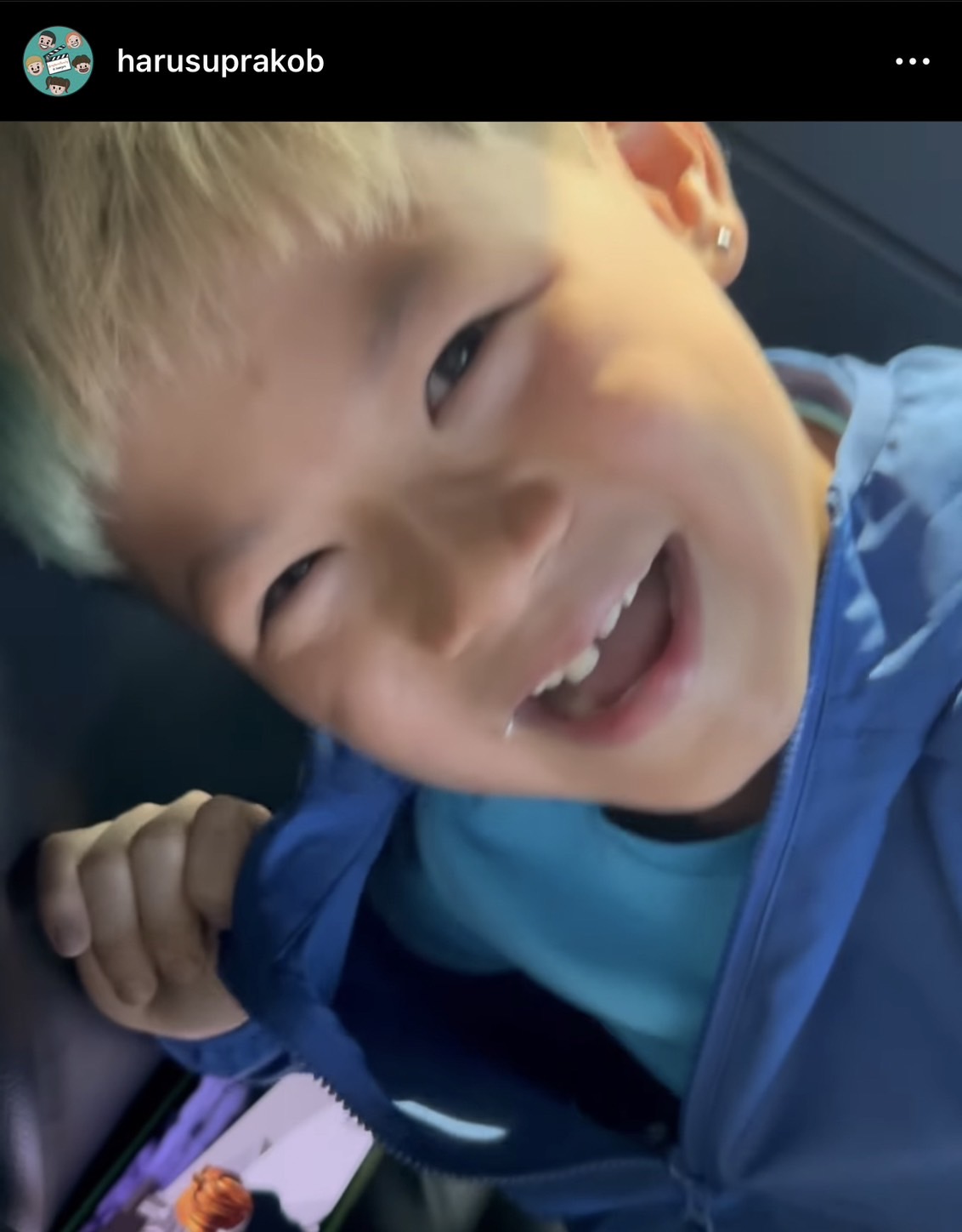 ร่วมส่งกำลังใจ กาย รัชชานนท์ ผ่าตัดกระดูกข้อมือและเส้นเอ็น ร่วมส่งกำลังใจ กาย รัชชานนท์ ผ่าตัดกระดูกข้อมือและเส้นเอ็น