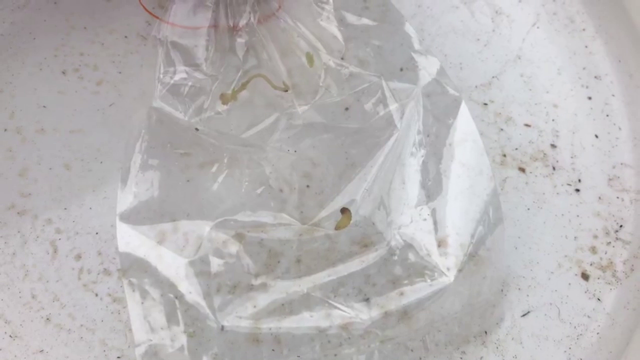 สาวใหญ่ป่วยโรคประหลาด! คล้ายหนอนโผล่ออกมาตามผิวหนัง สาวใหญ่ป่วยโรคประหลาด! คล้ายหนอนโผล่ออกมาตามผิวหนัง