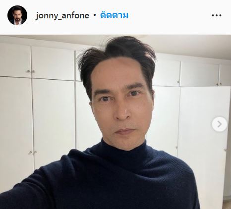 จอนนี่ แอนโฟนี่ เปิดโฉมหน้าใหม่ครั้งแรก!! หลังผ่าตัดศัลยกรรมยกหน้า ในวัย 52 ปี