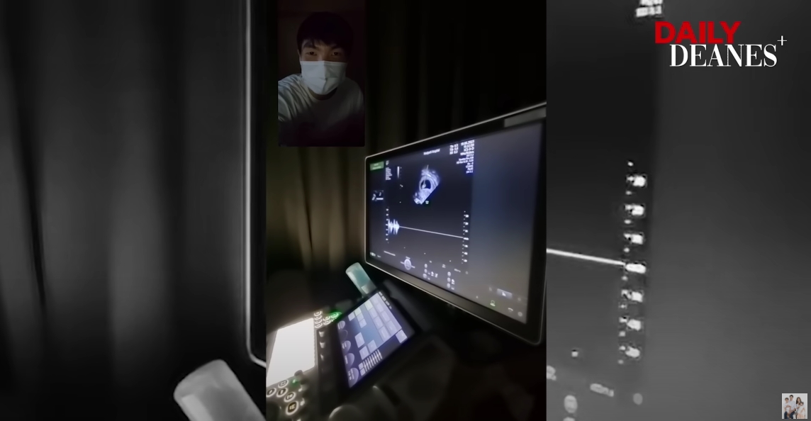 ลีเดีย เฉลยแล้ว! ภาพอัลตร้าซาวด์นั้นที่แท้เป็นลูกของน้องชาย ลีเดีย เฉลยแล้ว! ภาพอัลตร้าซาวด์นั้นที่แท้เป็นลูกของน้องชาย