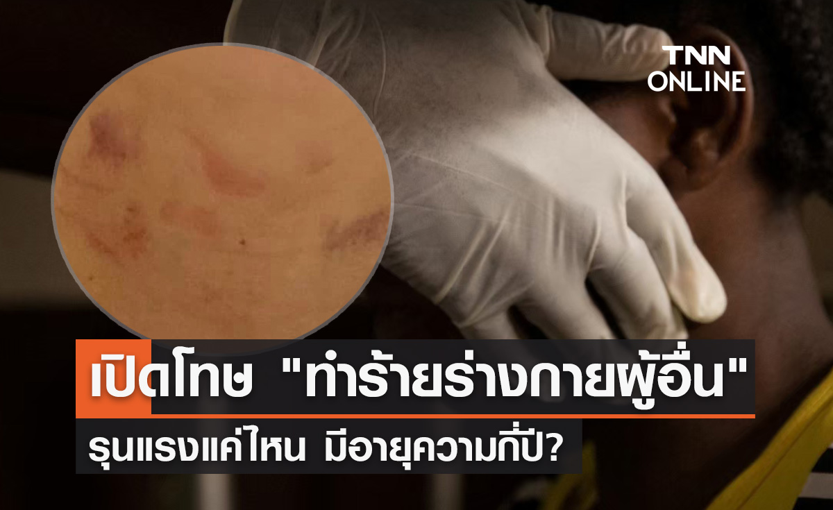 "ทำร้ายร่างกายผู้อื่น" รุนแรงแค่ไหน ต้องรับโทษอย่างไร มีอายุความกี่ปี?