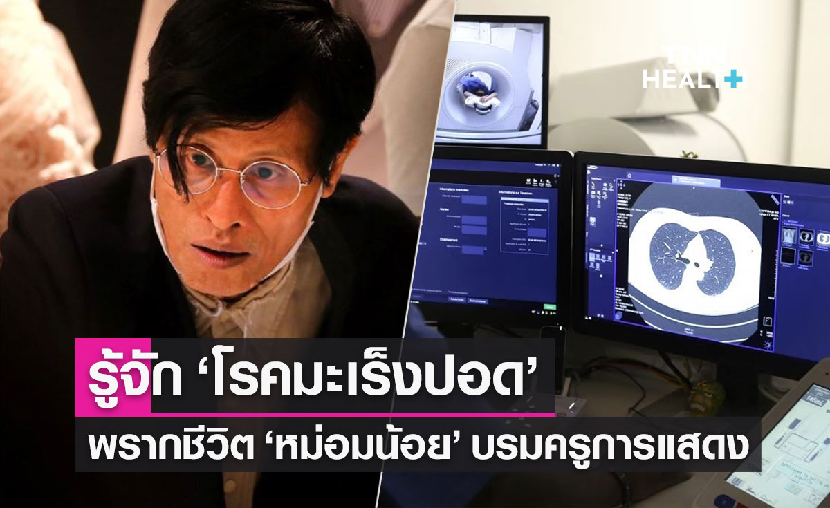 รู้จัก "โรคมะเร็งปอด" พราก "หม่อมน้อย" สาเหตุการเสียชีวิตอันดับ 2 ของคนไทย