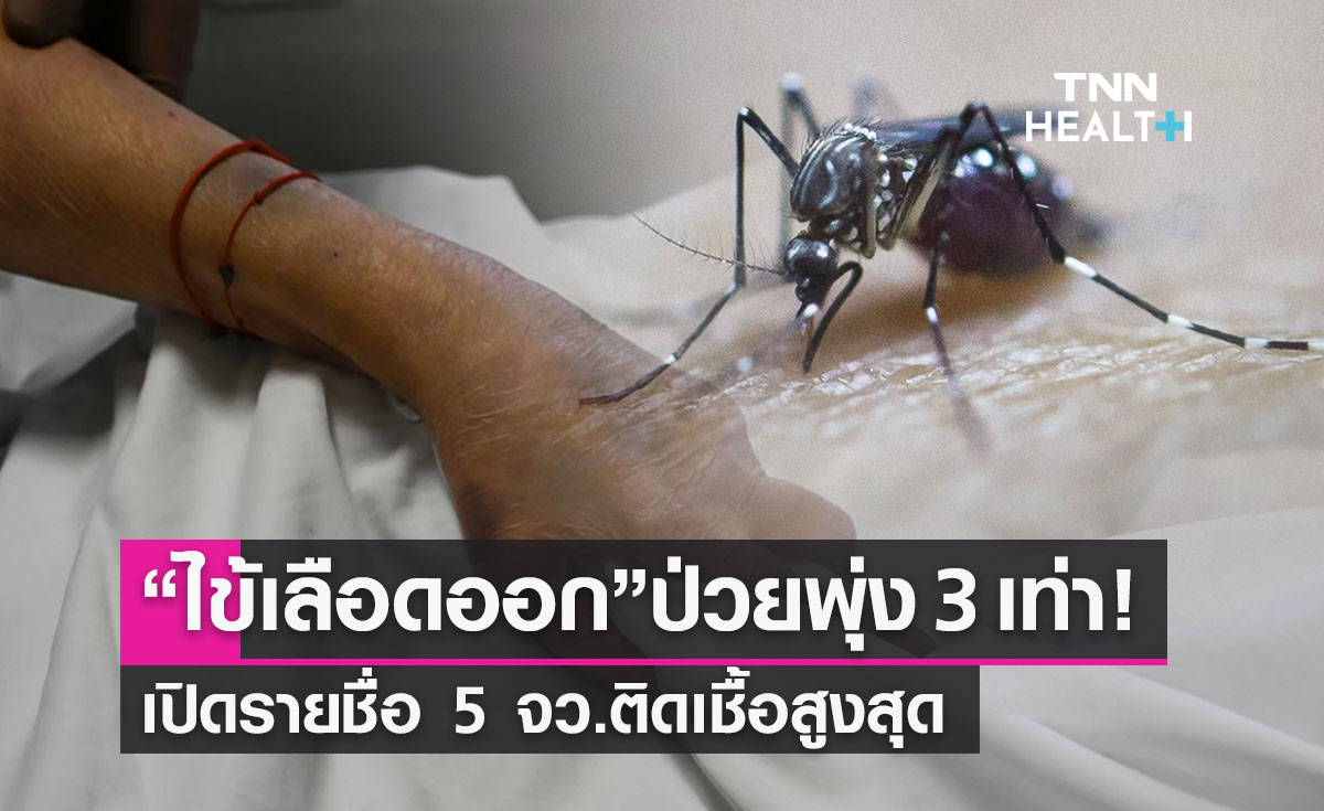 “ไข้เลือดออก” ล่าสุดป่วยพุ่ง 3 เท่า! เปิดรายชื่อ 5 จว.ติดเชื้อสูงสุด