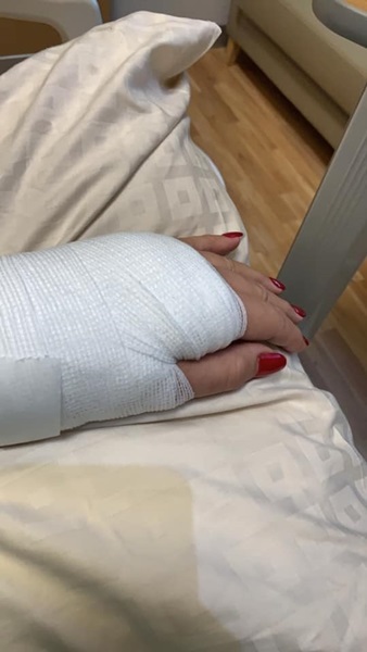 เหตุเพราะห่วง!! เบคกี้ ริสา หงษ์หิรัญ เกิดอุบัติเหตุ ลื่นล้มข้อมือหัก