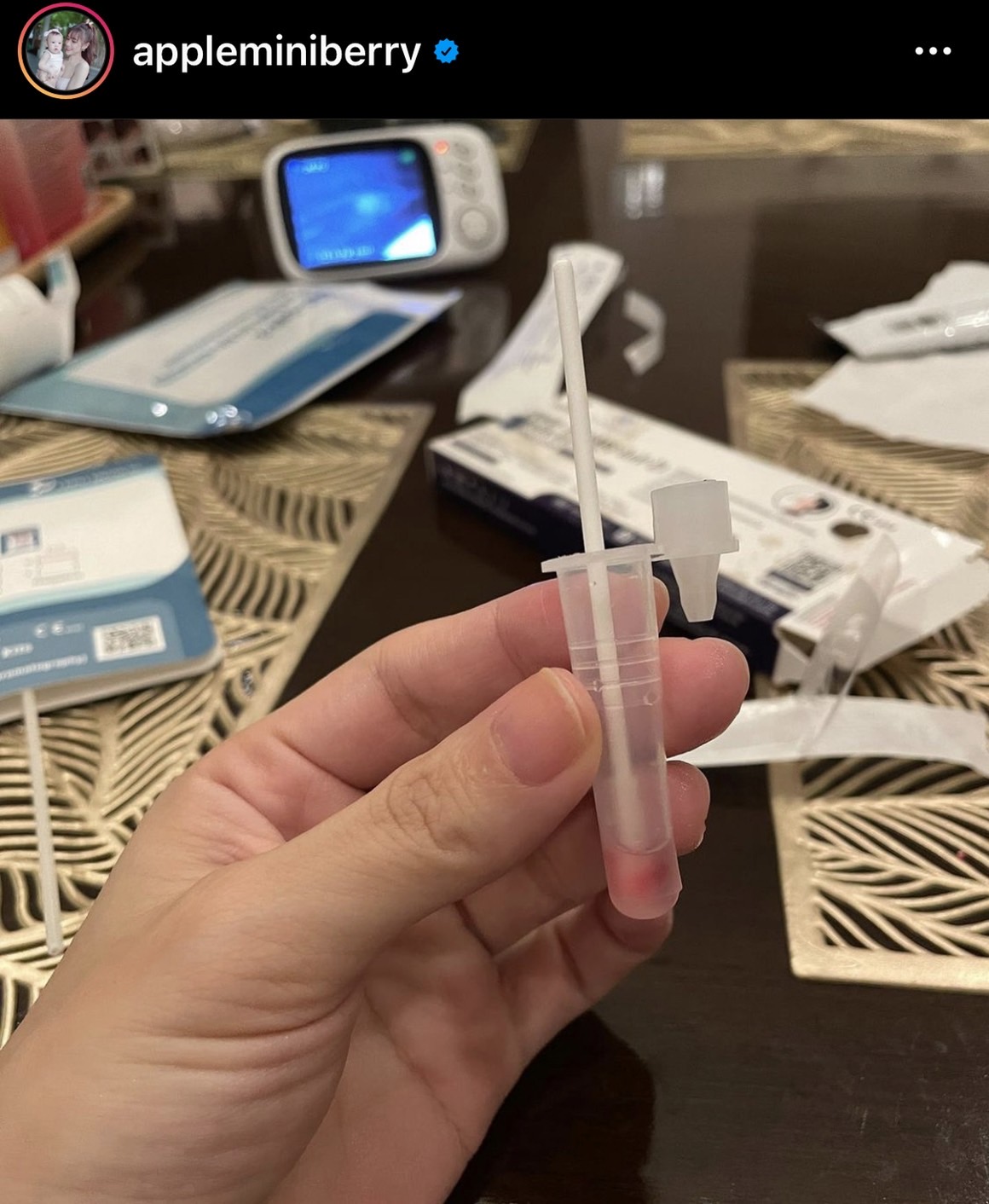 แอปเปิ้ล ตรวจ ATK จนเลือดไหล กลัวติดโควิด ใจจะขาดไม่กล้ากอดลูก