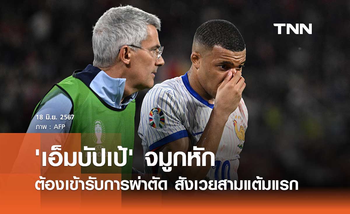 'เอ็มบัปเป้' จมูกหัก ต้องเข้ารับการผ่าตัด สังเวยสามแต้มแรก