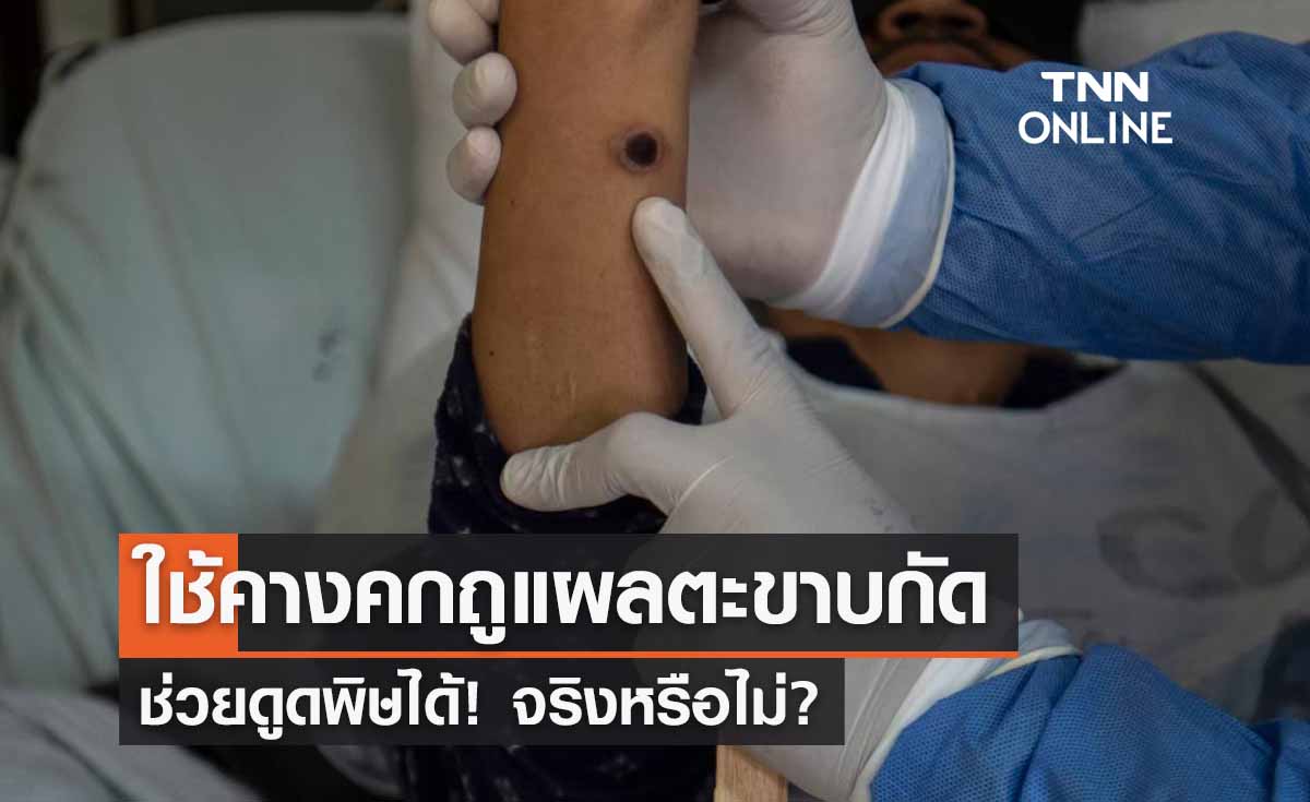 จริงหรือ! ใช้คางคกถูบริเวณที่ตะขาบกัดจะช่วยดูดพิษออกได้