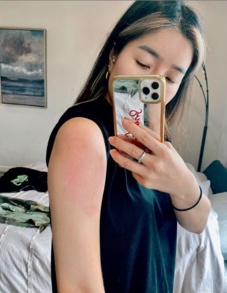 ทรมานมาก! จียอน รีวิวอาการหลังฉีดโมเดอร์นาเข็ม 2 