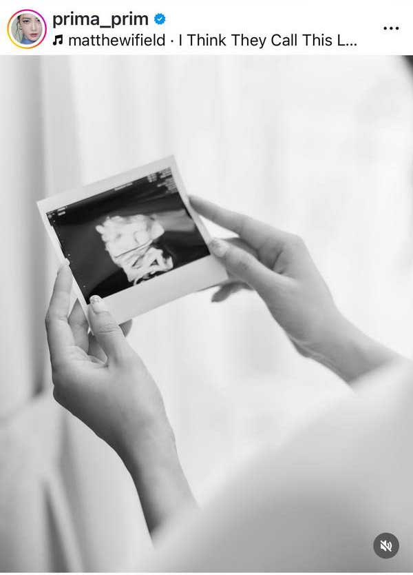 พริม พริมา อวดท้องแก่ 37 สัปดาห์ เตรียมนับถอยหลังพบหน้าลูกสาว พริม พริมา อวดท้องแก่ 37 สัปดาห์ เตรียมนับถอยหลังพบหน้าลูกสาว