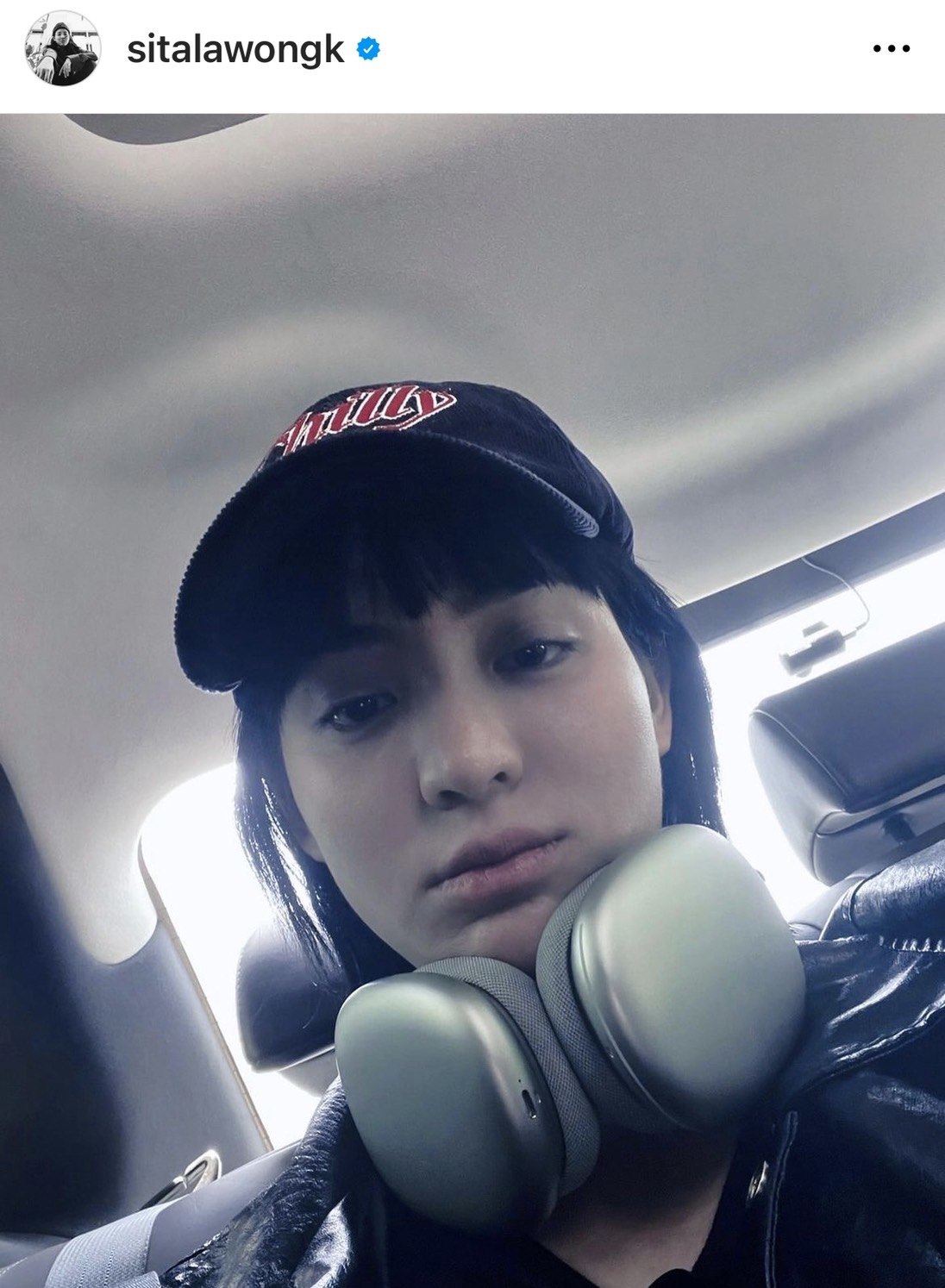 ลูกหนัง ศีตลา เปิดใจครั้งแรก ปมร้อน #แบนลูกหนัง