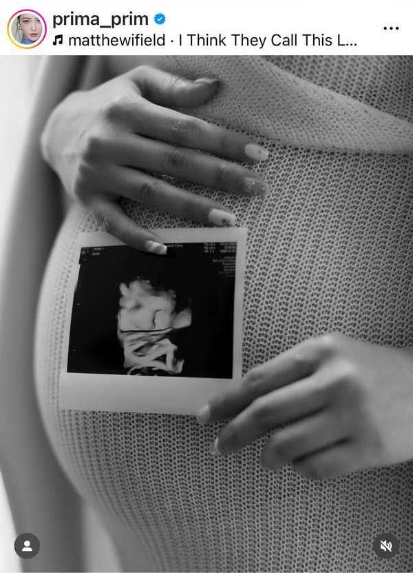 พริม พริมา อวดท้องแก่ 37 สัปดาห์ เตรียมนับถอยหลังพบหน้าลูกสาว พริม พริมา อวดท้องแก่ 37 สัปดาห์ เตรียมนับถอยหลังพบหน้าลูกสาว