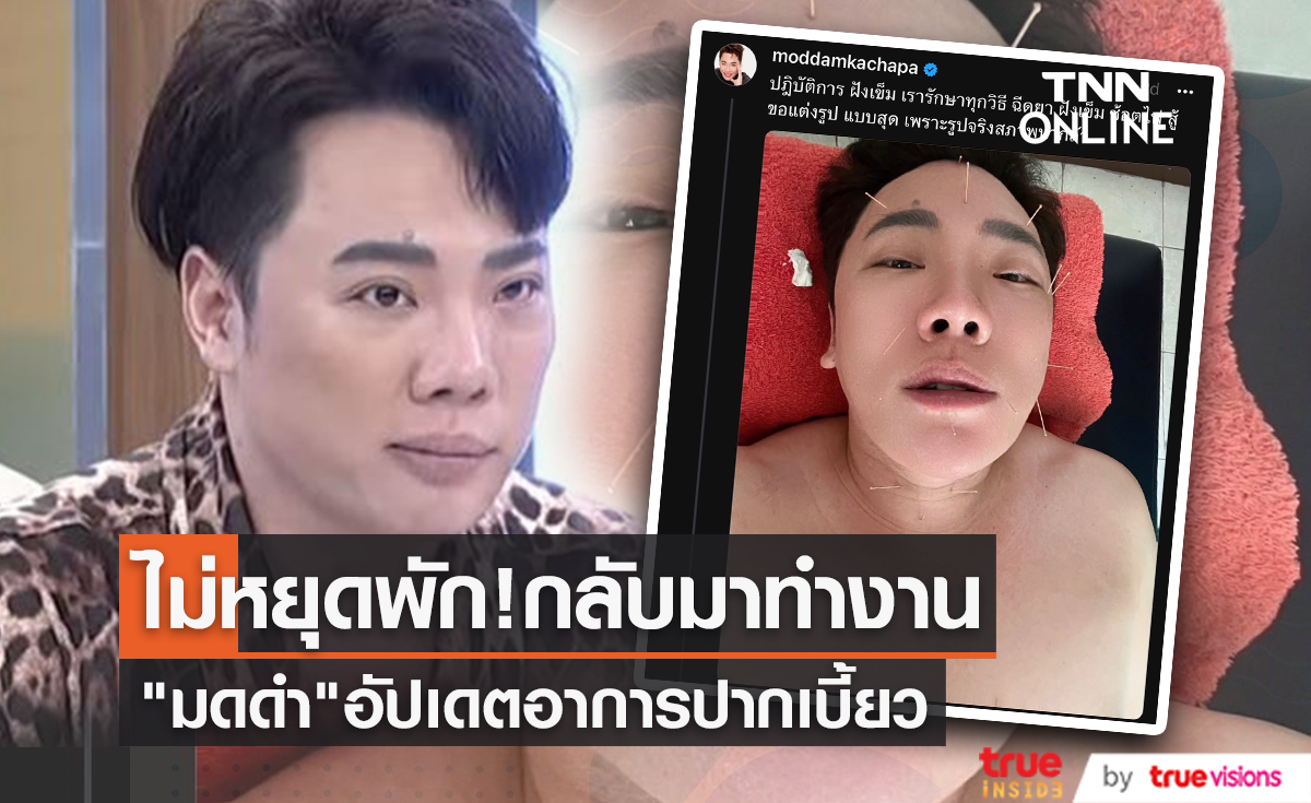 ไม่ยอมทิ้งงาน "มดดำ คชาภา" อัปเดตอาการปากเบี้ยว ยอมรักษาทุกทาง