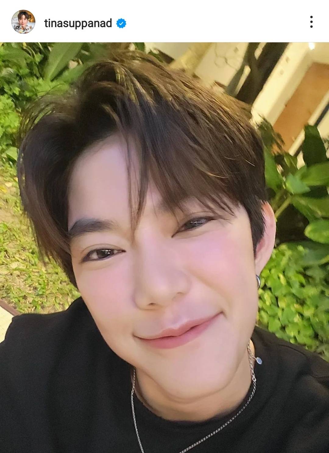 ติ๊นา ศุภนาฎ รับขับรถประมาท ยินดีรับผิดชอบค่าใช้จ่ายผู้บาดเจ็บ ติ๊นา ศุภนาฎ รับขับรถประมาท ยินดีรับผิดชอบค่าใช้จ่ายผู้บาดเจ็บ