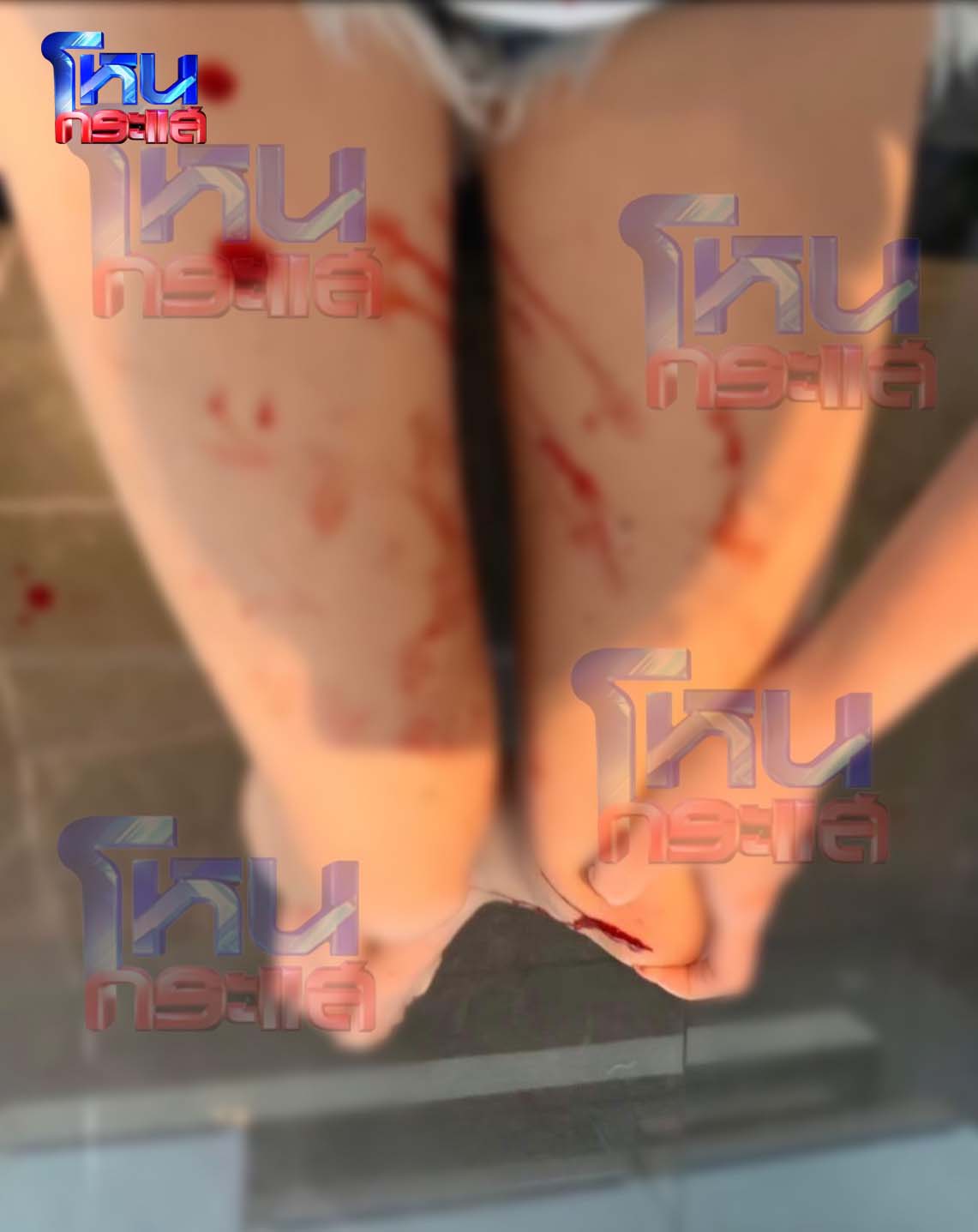 ชาวเน็ตตาดี สงสัยภาพที่ ดิว อริสรา ถูกทำร้ายร่างกาย คอสวมอะไรอยู่!? 