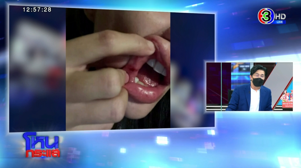 เติ้ล รับผิดเตะหน้า นิวนิว หอบดอกไม้ขอโทษ หนุ่ม กรรชัย ผวา!! นาทีลุกพรวดกลางรายการ เติ้ล รับผิดเตะหน้า นิวนิว หอบดอกไม้ขอโทษ หนุ่ม กรรชัย ผวา!! นาทีลุกพรวดกลางรายการ