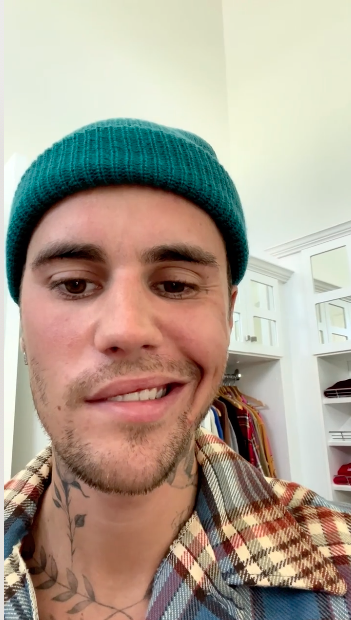 ดีขึ้นมาก!! 'จัสติน บีเบอร์' ยิ้มกว้างอัปเดตอาการอัมพาตใบหน้าครึ่งซีก ดีขึ้นมาก!! 'จัสติน บีเบอร์' ยิ้มกว้างอัปเดตอาการอัมพาตใบหน้าครึ่งซีก