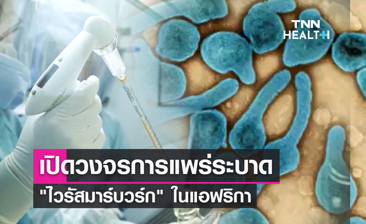 "ไวรัสมาร์บวร์ก" ศูนย์จีโนมฯเปิดวงจรการแพร่ระบาด