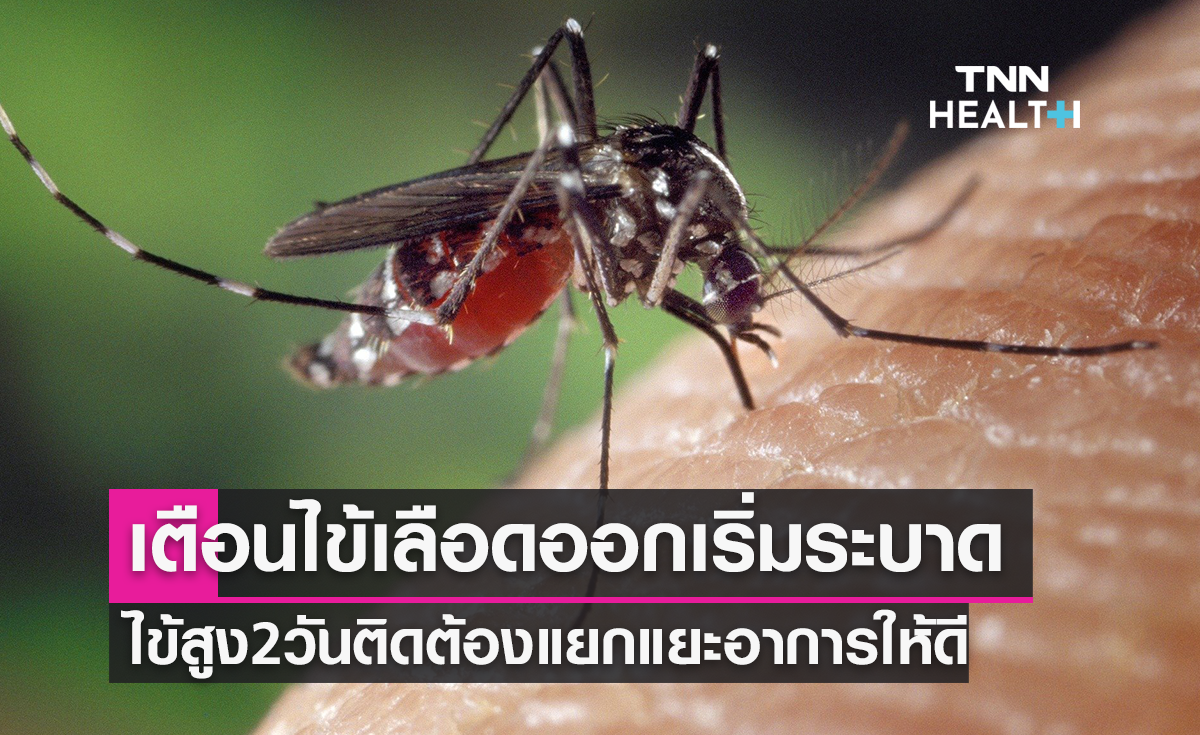 “ไข้เลือดออก” ส่อแววระบาดหนักปีนี้ กรมควบคุมโรค เตือนให้สังเกตอาการเปรียบเทียบกับ "โควิด" ให้ดี