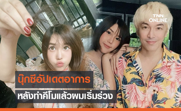 กำลังใจดี "นุ๊กซี่" แฟน "ปู แบล็คเฮด" อัปเดตผมร่วงหลังทำคีโม