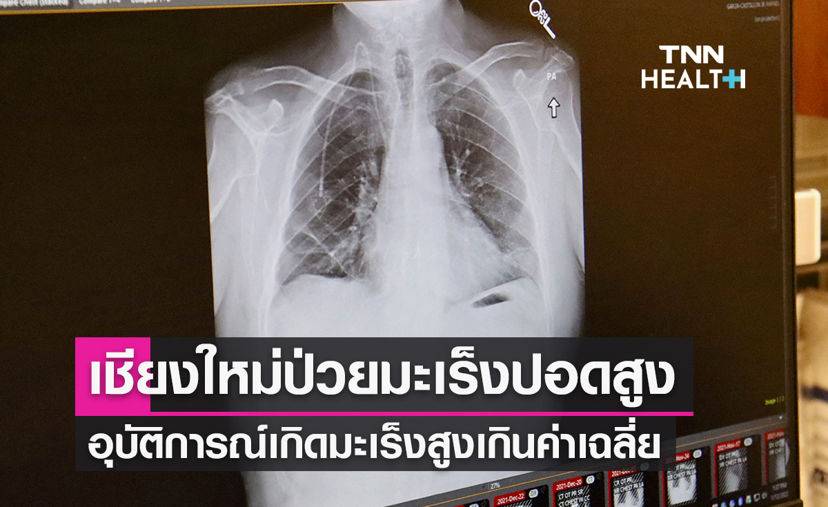 น่าห่วง!หมอเผยเชียงใหม่ป่วยมะเร็งปอดสูง อุบัติการณ์เกิดมะเร็งเกินค่าเฉลี่ย