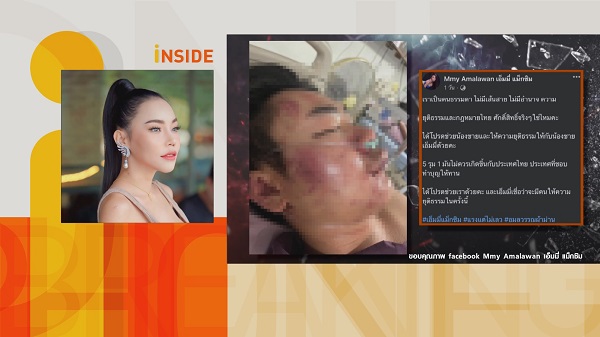 “เอ็มมี่ แม็กซิม”  ยืนยันคลิปรุ่นน้องตบหน้าการ์ด เป็นการป้องกันตัว    (มีคลิป) 