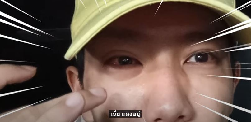 แอ็ดมิทด่วน!! เพราะเหตุนี้ เกรท สพล เผยสาเหตุเป็น ไวรัสตาแดง