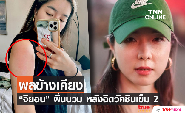 "จียอน" ฉีดวัคซีนเข็ม 2 เจออาการข้างเคียง