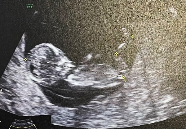 น้ำชา ชีรณัฐ เผยทราบเพศลูกแล้ว แต่ขออุบไว้ก่อน!! น้ำชา ชีรณัฐ เผยทราบเพศลูกแล้ว แต่ขออุบไว้ก่อน!!