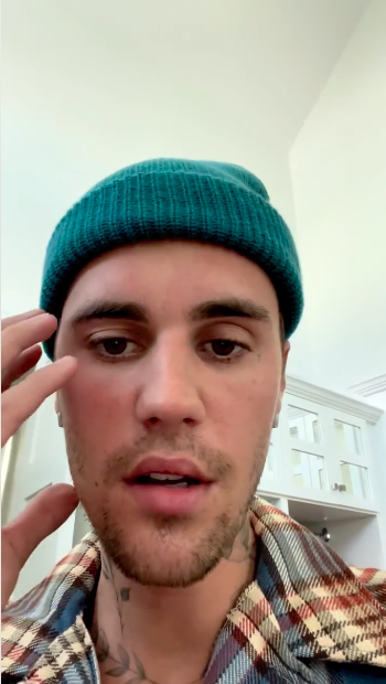 ดีขึ้นมาก!! 'จัสติน บีเบอร์' ยิ้มกว้างอัปเดตอาการอัมพาตใบหน้าครึ่งซีก ดีขึ้นมาก!! 'จัสติน บีเบอร์' ยิ้มกว้างอัปเดตอาการอัมพาตใบหน้าครึ่งซีก