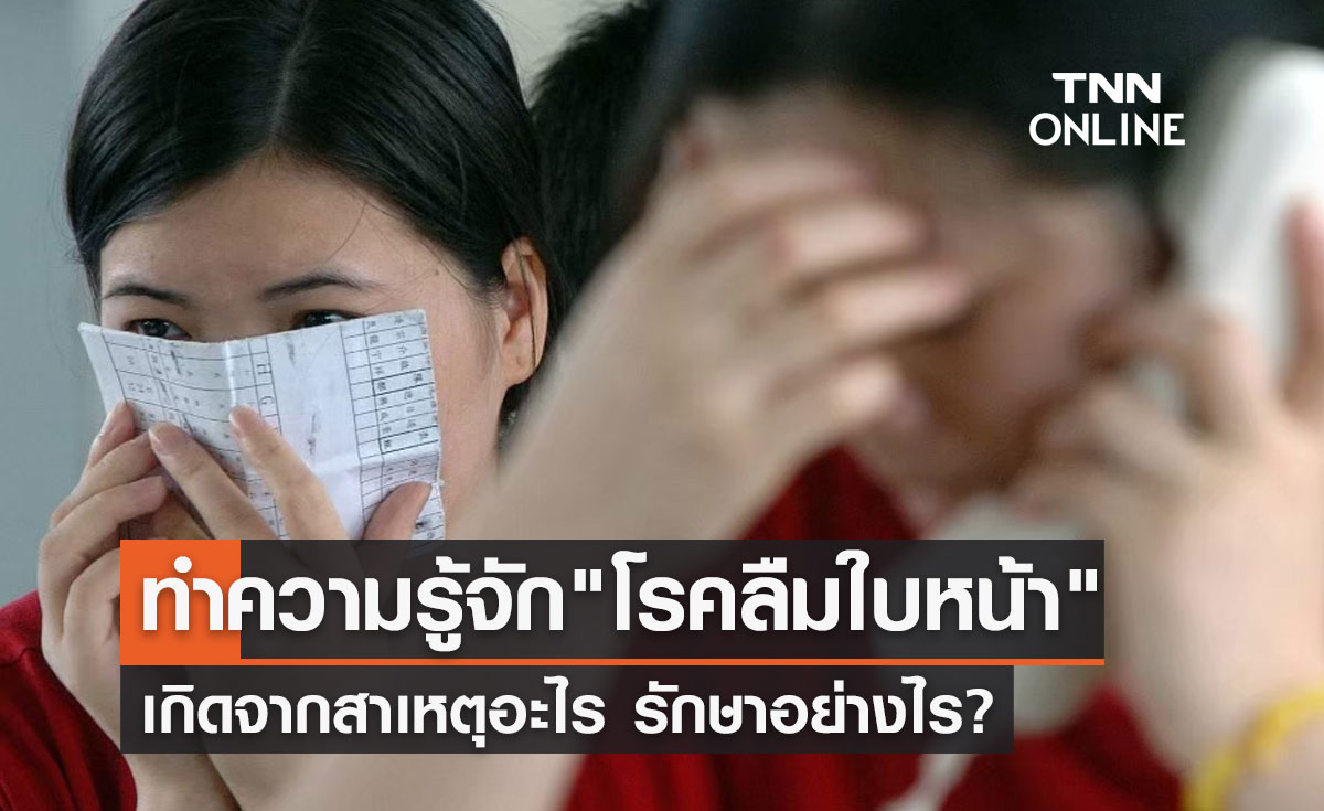 "โรคลืมใบหน้า" เกิดจากสาเหตุอะไร? จำไม่ได้แม้แต่คนใกล้ตัว