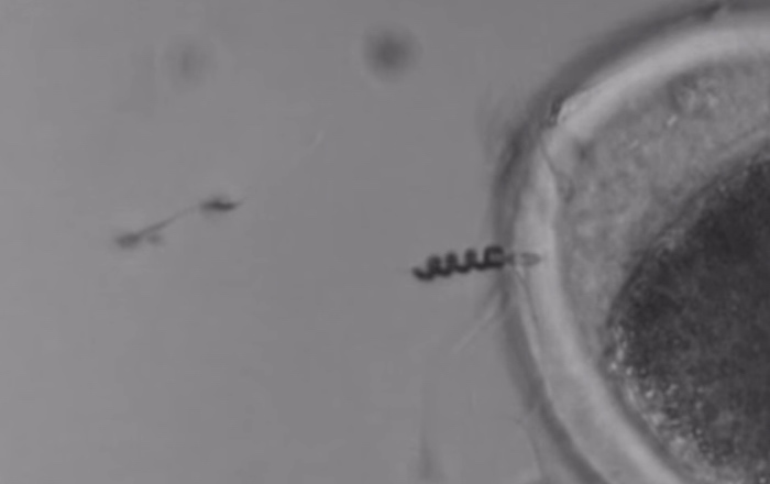 สเปิร์มบอต (Spermbot) รถแท็กซี่ของตัวอสุจิ ช่วยแก้ปัญหาภาวะเป็นหมันจากตัวอสุจิเคลื่อนไหวน้อย