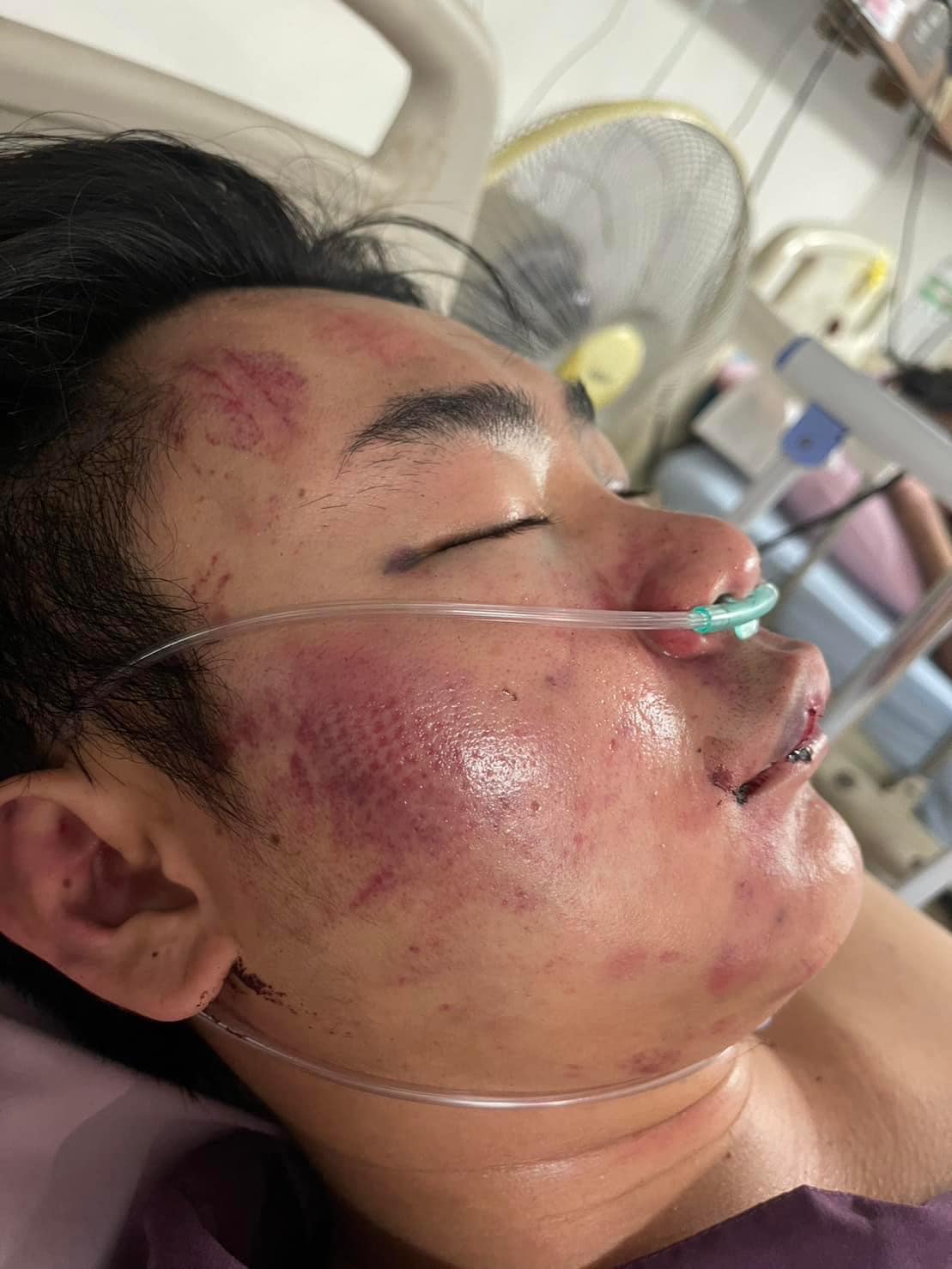 เอ็มมี่ ทวงถามความยุติธรรม น้องโดน 5 รุม 1 เอ็มมี่ ทวงถามความยุติธรรม น้องโดน 5 รุม 1