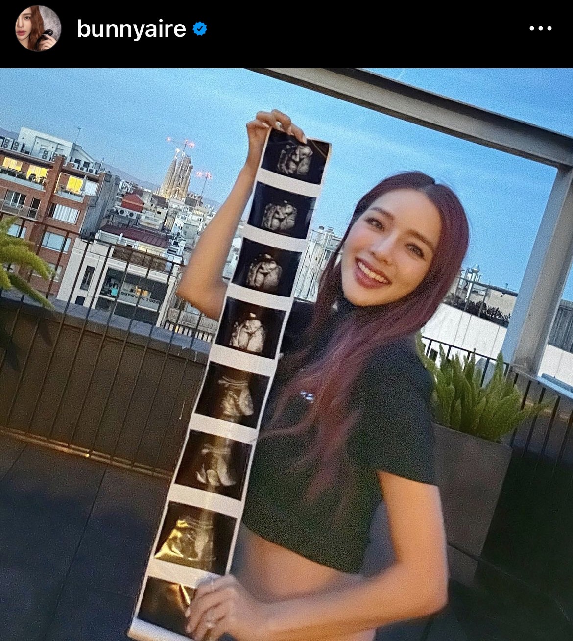 แอร์ ภัณฑิลา ชวนทายเพศลูกคนแรก เผยความรู้สึกหลังขึ้นแท่นเป็นคุณแม่ป้ายแดง 