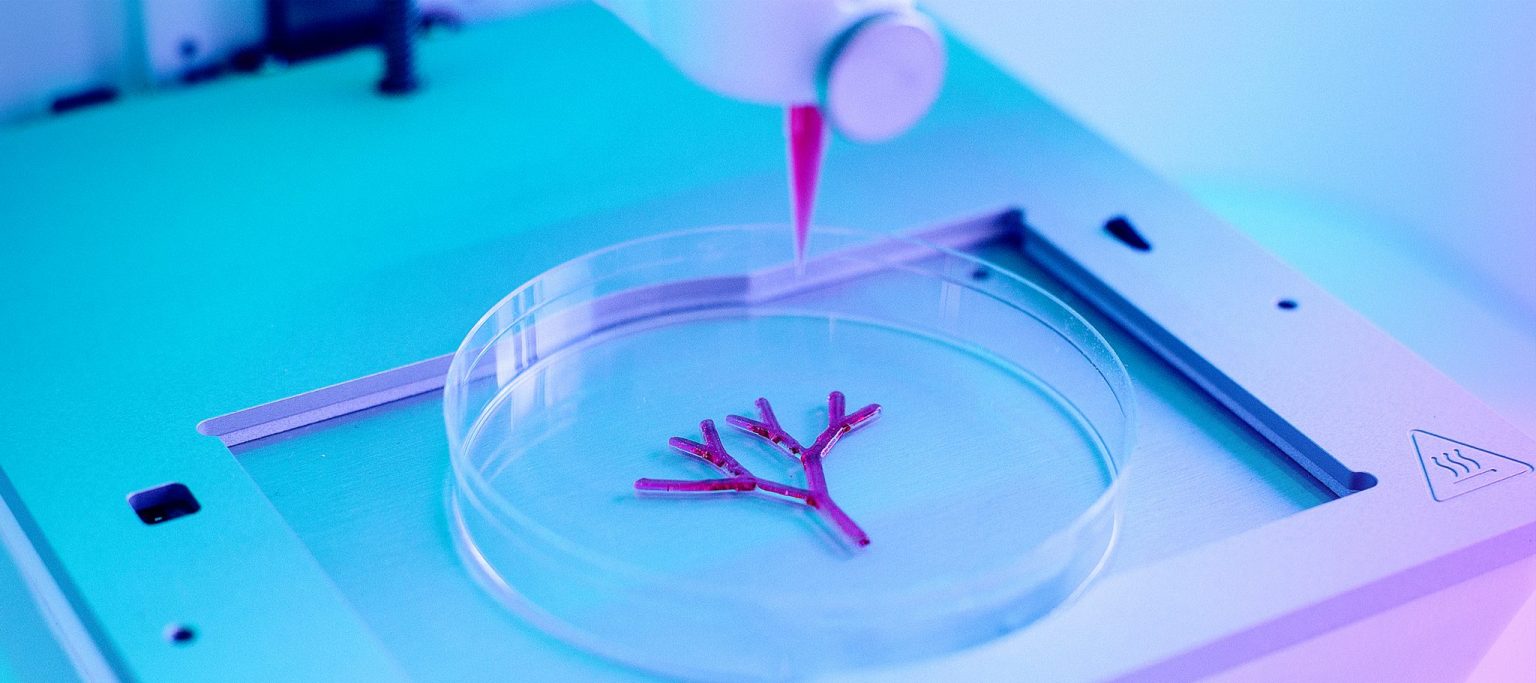 สร้าง ไต ด้วย 3D-printing เพื่อใช้เป็นอวัยวะปลูกถ่ายในผู้ป่วยไตวายเรื้อรัง สร้าง ไต ด้วย 3D-printing เพื่อใช้เป็นอวัยวะปลูกถ่ายในผู้ป่วยไตวายเรื้อรัง