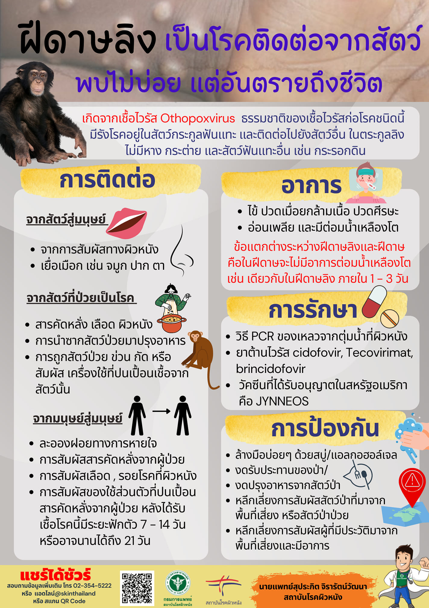 แพทย์ผิวหนังเตือน ฝีดาษลิง เป็นโรคติดต่อจากสัตว์ที่พบไม่บ่อย แต่อันตรายถึงชีวิต